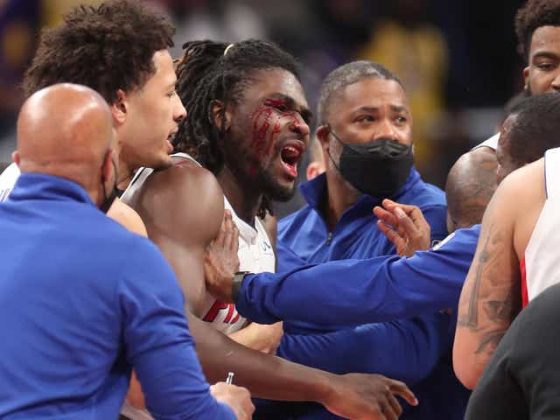 Pistons’ Isaiah Stewart remorseful, received six or seven stitches across bloodied eye – HC Dwane Casey